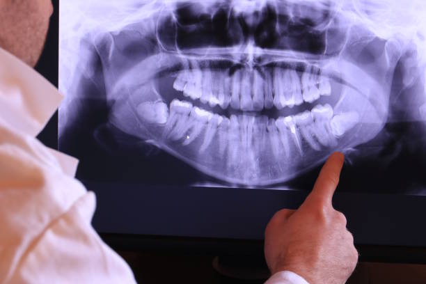 Best Emergency Treatment for Toothache in Wilsonville, AL